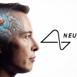 Neuralink