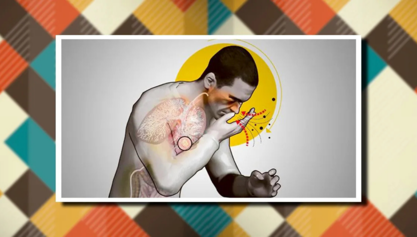 Imagen representativa de tuberculosis en México. Dibujo hombre tosiendo. FOTO: UNAM Global